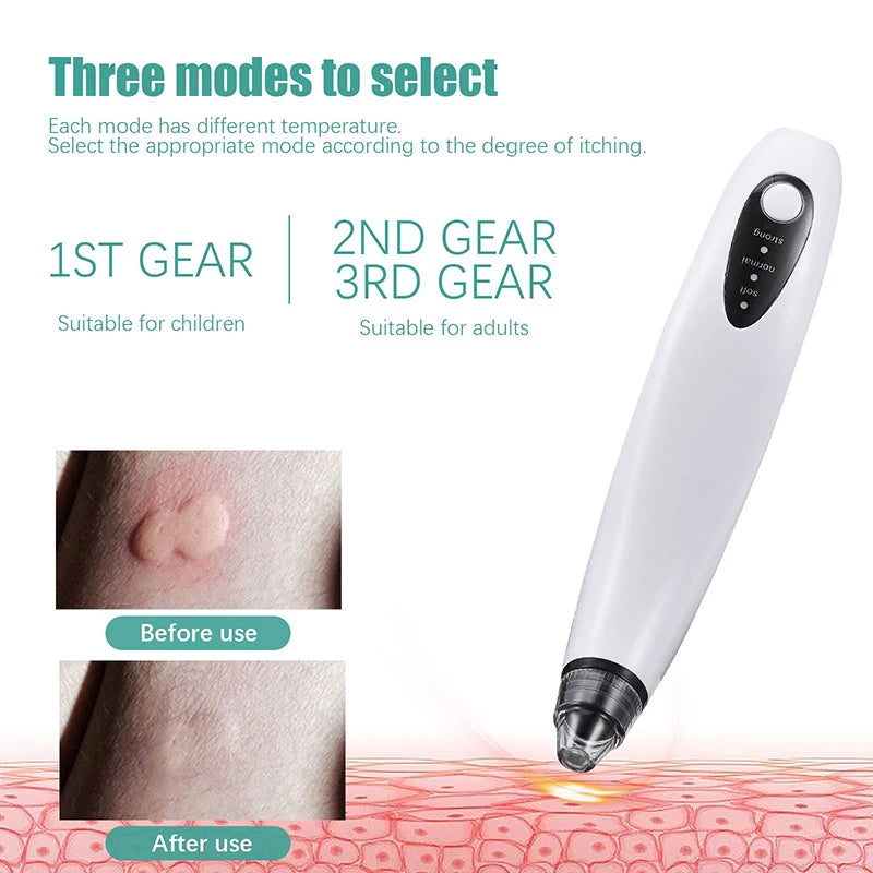 Electronic Mosquito Bites Itch Relief Pen Suction Tool Bug Bite Thing Suction Tool Bee Wasp Stings Natural Insect Bite Relief