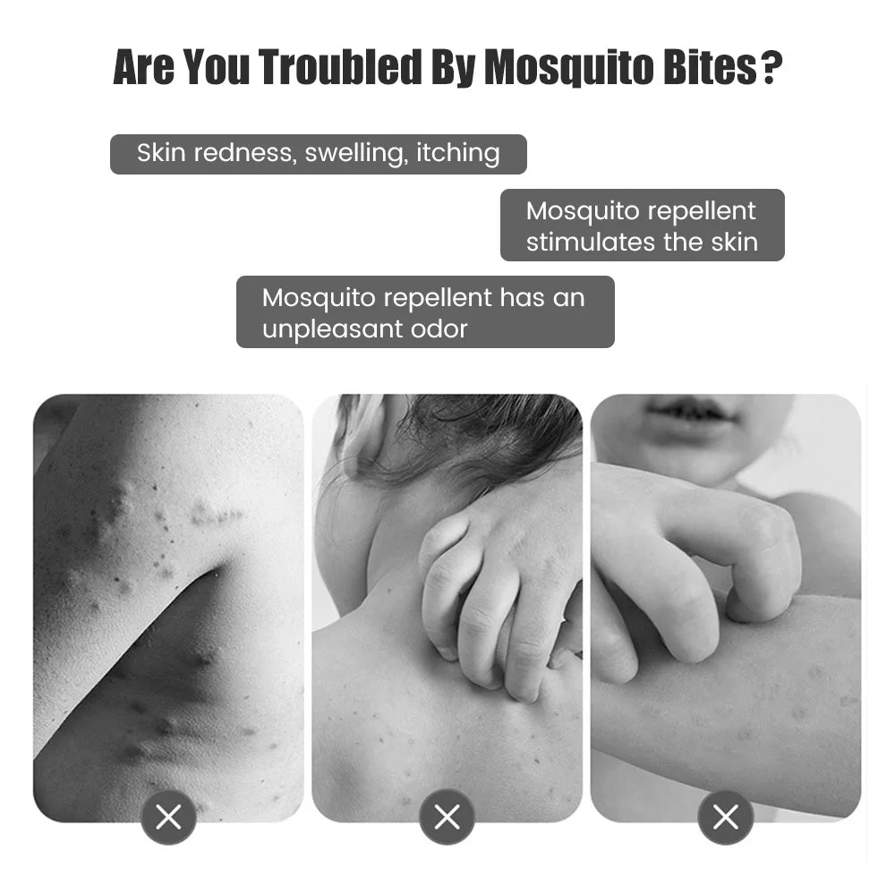 Insect Sting and Bite Relief Device for Symptom Relief From Itching and Swelling Rechargeable Bug Bite Healer for Mosquito Bites