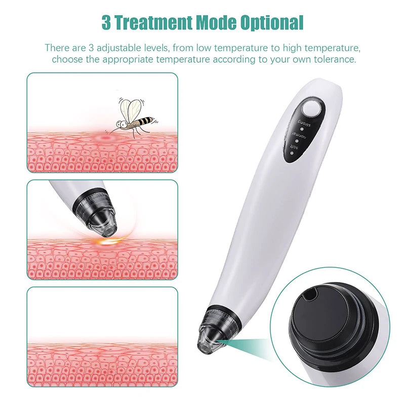 Electronic Mosquito Bites Itch Relief Pen Suction Tool Bug Bite Thing Suction Tool Bee Wasp Stings Natural Insect Bite Relief